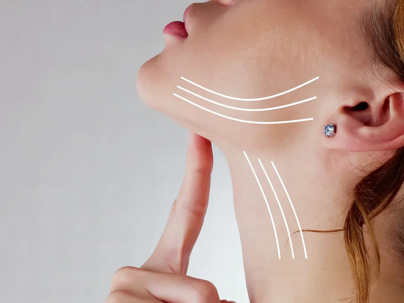 Jawline Contouring and Neck Lifting Vectors A profile view of a woman pointing to her chin and jawline with white graphic vector lines overlaid on the jaw and neck